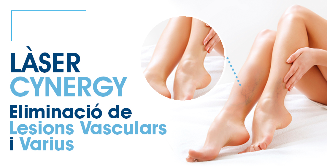 eliminació varius làser cinergy