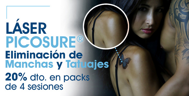 eliminación de tatuajes