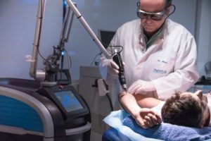 eliminació tatuatges picosure