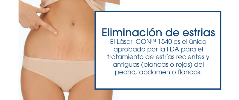 eliminación de estrías