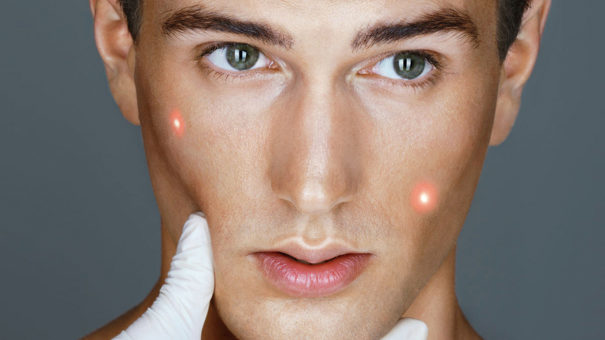 biorebitalització facial