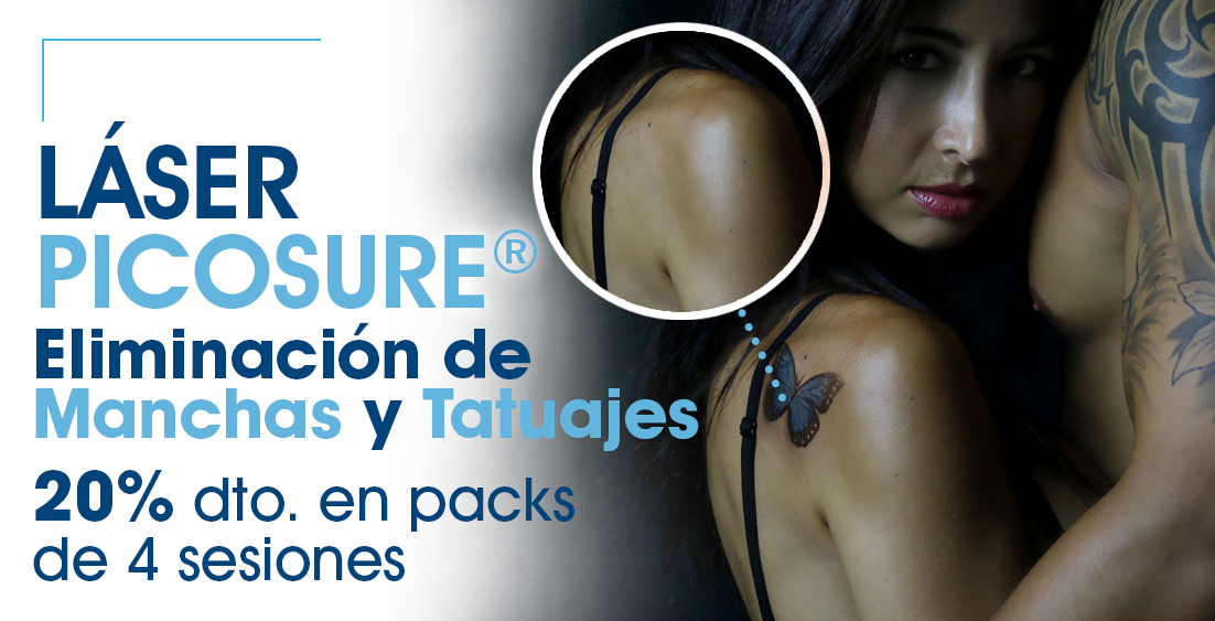 eliminació tatuatges