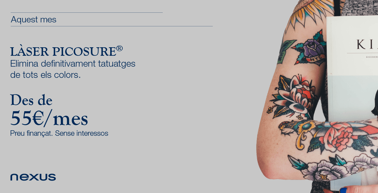 Eliminació tatuatges nexus