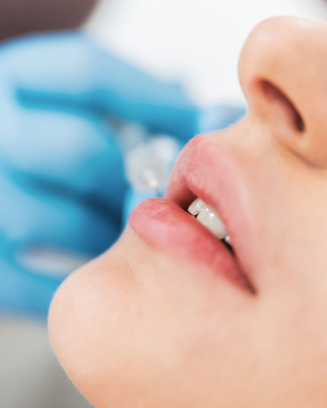 labios