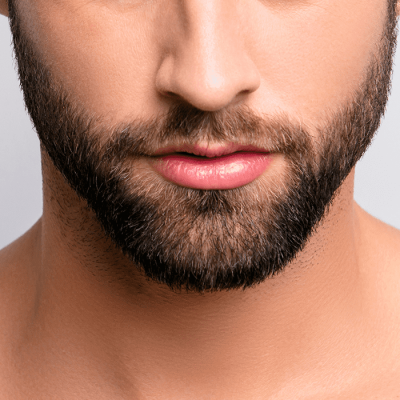 barba trasplante