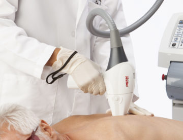 Depilació laser VECTUS